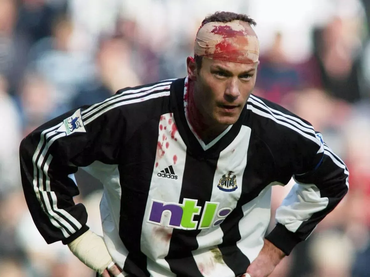 1 Alan Shearer of Newcastle covered in blood from a head wound